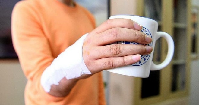 Ege Üniversitesi'nde el bileği protezi geliştirildi